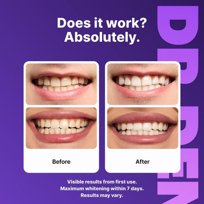 Purple Smile Strips ™